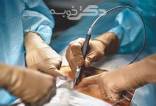 بهترین دکتر شقاق در تهران