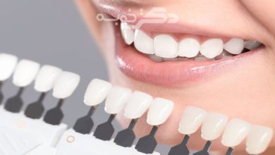بهترین کلینیک دندان پزشکی الهیه تهران