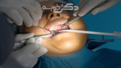 بهترین کلینیک دندانپزشکی با لیزر در تهران
