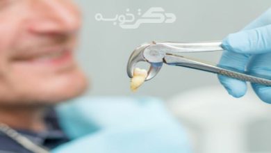 بهترین جراح دندان عقل در شرق تهران
