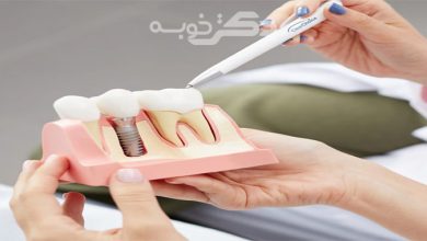 بهترین دکتر متخصص ایمپلنت دندان در شهر قدس