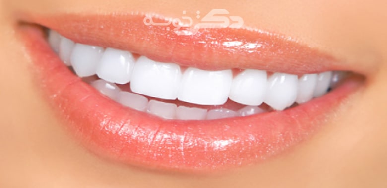 best-composite-dental-doctor-in-zafaranieh-3.jpg
