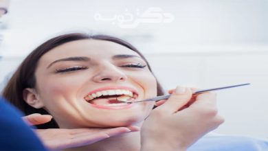 بهترین دکتر کامپوزیت دندان نظراباد