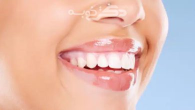 بهترین دندانپزشک زیبایی در رودهن