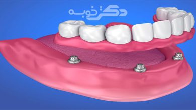 بهترین کلینیک دندان مصنوعی در اسلامشهر