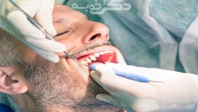 بهترین جراح دندان عقل در اسلامشهر