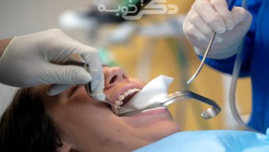 بهترین جراح دندان عقل در شهریار